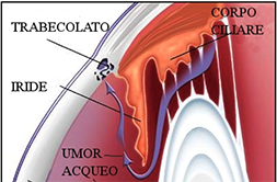 glaucoma ritagliato